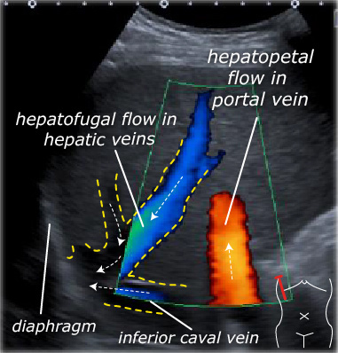 Upper Extremity Veins