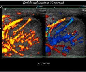 Upper Extremity Veins